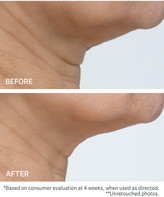 Thumbnail for your product : StriVectin R)-TL(TM) 'The Big Deal' Jumbo Advanced Tightening Neck Cream