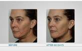 Thumbnail for your product : NuFace Trinity Microcurrent Facial Toning Device w/ ELE & Year of Gels