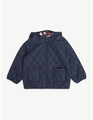 Tommy Hilfiger Reversible shell jacket 0-24 months