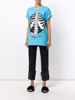 Thumbnail for your product : Jeremy Scott ribbed cage print T-shirt