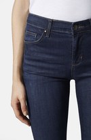 Thumbnail for your product : Topshop Moto 'Leigh' Vintage Jeans (Dark Denim)