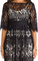 Thumbnail for your product : BB Dakota Jessica Scallop Lace Dress