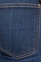 Thumbnail for your product : Current/Elliott 'The Zip Stiletto' Skinny Jeans (Bowler)