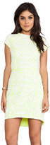 Thumbnail for your product : Dolce Vita Aletta Tribal Lace Short Sleeve Dress