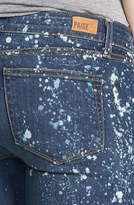 Thumbnail for your product : Paige Denim 'Edgemont' Zip Detail Bleach Splatter Skinny Jeans (Corrosion)