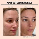 Thumbnail for your product : Peace Out Cleansing Balm Cleanser