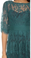 Thumbnail for your product : BB Dakota Scallop Lace Dress