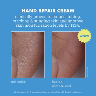 Skinfix Hand Repair Cream