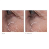 Thumbnail for your product : Kate Somerville Tight'N Cryogenic Tightening Gel