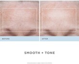 Thumbnail for your product : NuFace Trinity Wrinkle Reducer Attachment