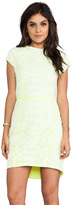 Thumbnail for your product : Dolce Vita Aletta Tribal Lace Short Sleeve Dress