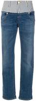 Thumbnail for your product : Roberto Cavalli striped detail straight jeans