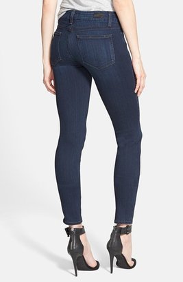 Paige Denim 'Jolene' Zip Ultra Skinny Jeans (Cameron Blue)