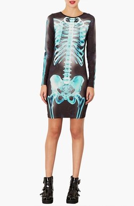 Topshop 'X-Ray Skeleton' Print Body-Con Dress