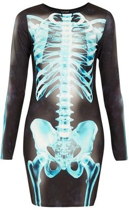 Topshop 'X-Ray Skeleton' Print Body-Con Dress